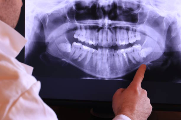 Best Emergency Root Canal Therapy in Lees Summit, MO